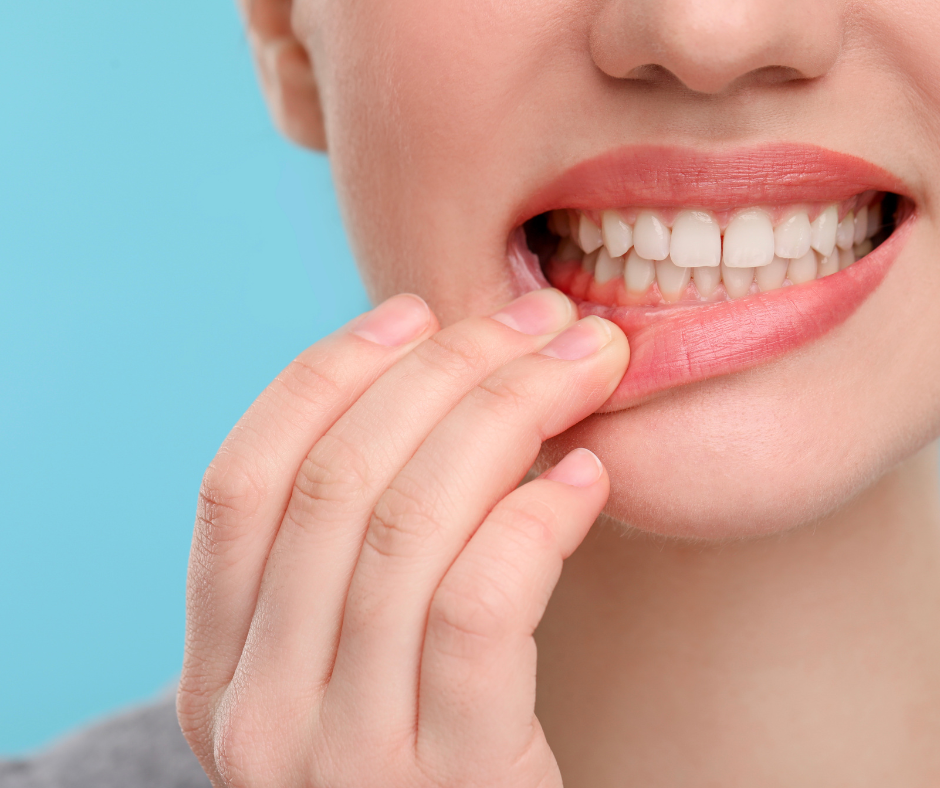 Teeth Gum Treatment