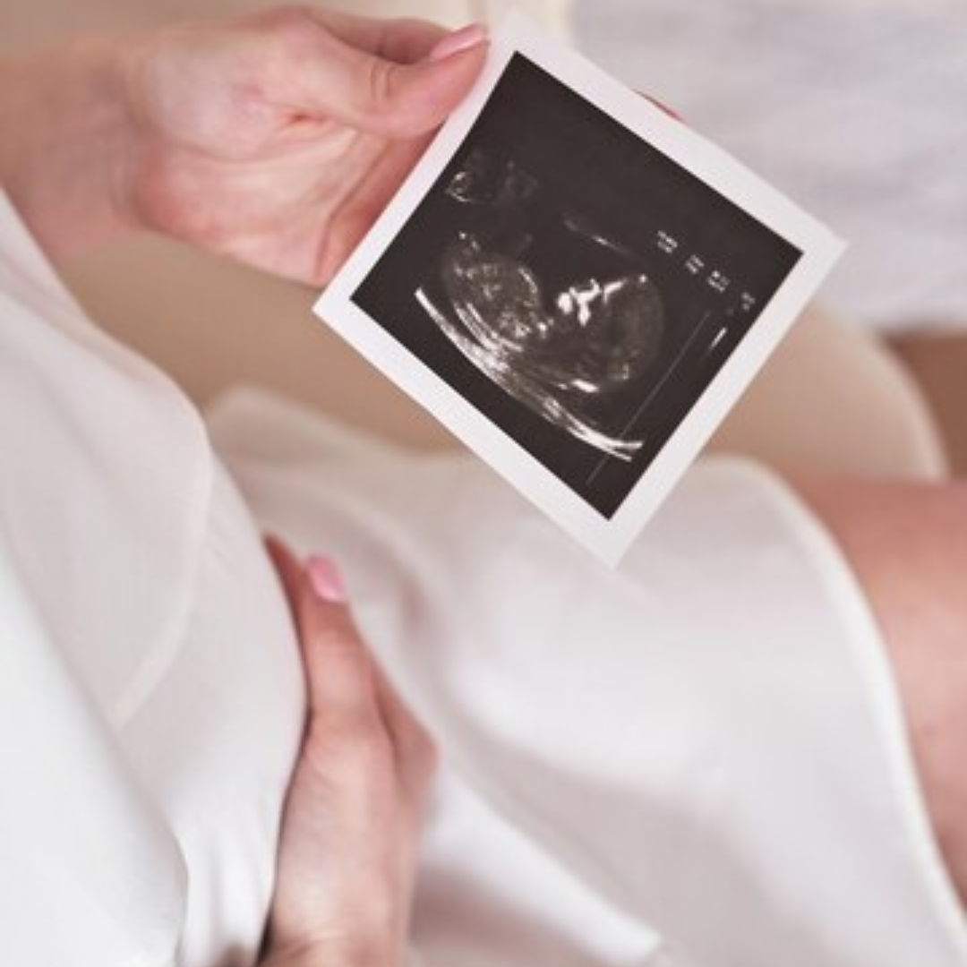Private Gender Scan UK